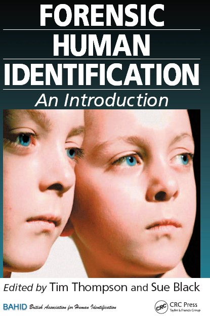 cover image of the book Forensic human identification