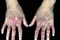 a photo of skin disorders