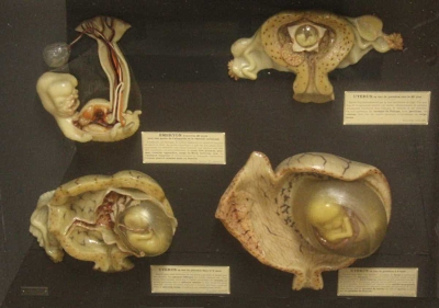 Embryo model