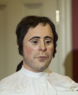 picture shows the reconstructed head of Burns
